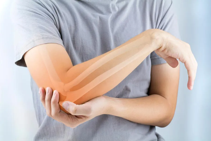 A close-up of a woman holding her elbow with an illustration of the bones and joint experiencing pain from osteoporosis. Get osteoporosis treatment from Don D. Fisher, D.O. at The BEST Program in Fort Lauderdale.
