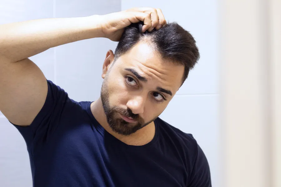 A man in a navy t-shirt looks in the mirror worrying about and touching his receding hairline, considering PRP for hair loss and restoration treatment from Don D. Fisher, D.O. at The BEST Program in Fort Lauderdale.